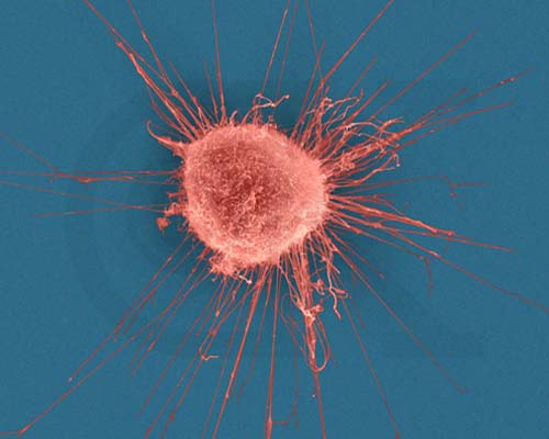 File:Cancer-cell.jpeg